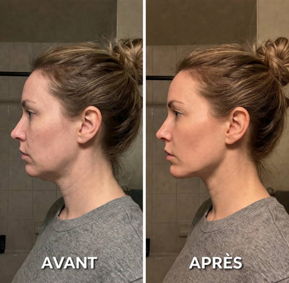 La brosse lymphatique visage